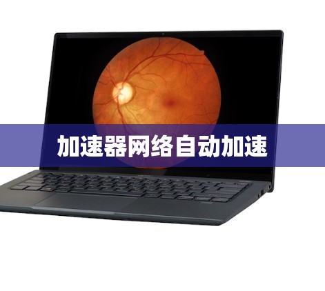加速器网络自动加速 加速器网络自动加速